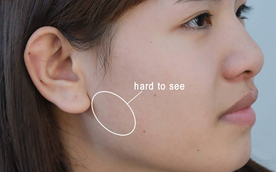 Hair Identifier Spray - Free Delivery